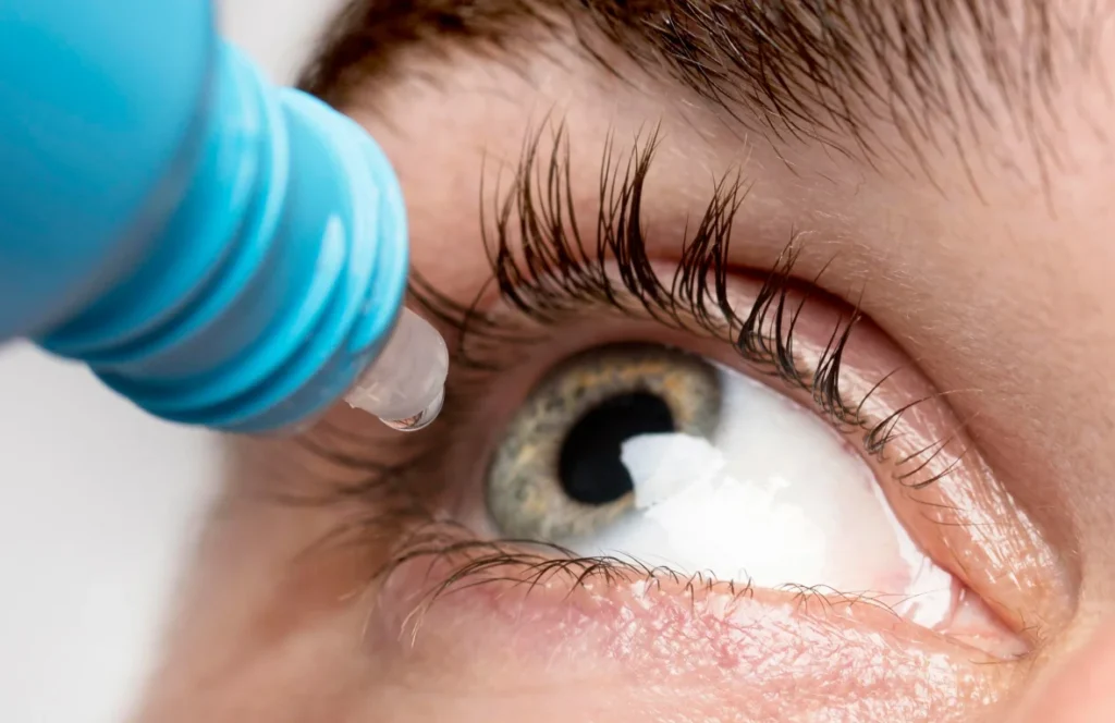 Eye examine - Dr Cole Rojas
